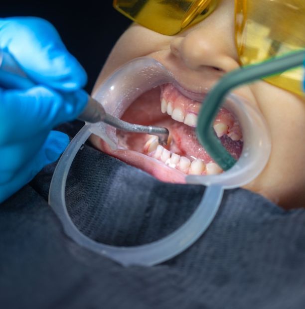 gum therapy treatment