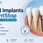 Dental implants in Bangalore at DentStop Speciality Dental Care