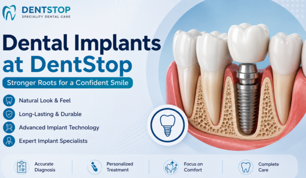Dental implants in Bangalore at DentStop Speciality Dental Care